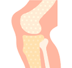 Bone Cancer